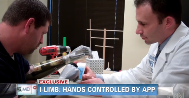 bionic hands